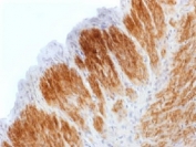 IHC testing of FFPE rat uterus stained with recombinant Calponin antibody (clone CNN1/1408R). Required HIER: steam sections in 1mM EDTA, pH9, for 10-20 min followed by cooling at RT for 20 min.
