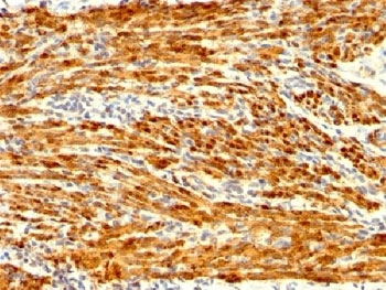 IHC testing of FFPE human uterus stained with recombinant Calponin antibody (clone CNN1/1408R). Required HIER: steam sections in 1mM EDTA, pH9, for 10-20 min followed by cooling at RT for 20 min.~