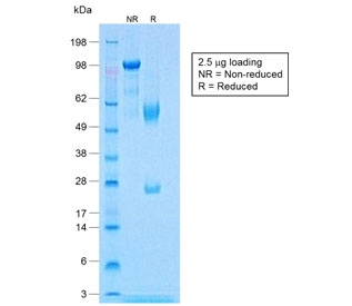 SDS-PAGE analysis of purified, BSA-free recombinant Calponin antibody (clone CNN1/1408R) as confirmation of integrity and purity.