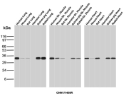 Calponin Antibody Multi-Species Tissue WB. Western blot analysis of human lung lysate, mouse lung lysate, rat lung lysate, hamster lung lysate, guinea pig lung lysate, rabbit lung lysate, human skeletal muscle lysate, mouse skeletal muscle lysate, rat skeletal muscle lysate, hamster skeletal muscle lysate, guinea pig skeletal muscle lysate, rabbit skeletal muscle lysate, human heart lysate, mouse heart lysate, rat heart lysate, hamster heart lysate, guinea pig heart lysate, and rabbit heart lysate using Calponin antibody. The recombinant rabbit monoclonal antibody clone CNN1/1408R detects a band at approximately 34 kDa, consistent with the predicted molecular weight of Calponin 1 / CNN1. Signal across multiple tissues reflects expression in smooth muscle-containing structures and supports its role in actin-associated cytoskeletal organization.