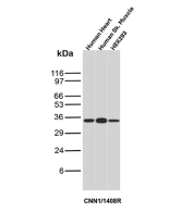 Calponin Antibody Heart, Skeletal Muscle and HEK293 WB. Western blot analysis of human heart lysate, human skeletal muscle lysate, and HEK293 cell lysate using Calponin antibody. The recombinant rabbit monoclonal antibody clone CNN1/1408R detects a band at approximately 34 kDa, consistent with the predicted molecular weight of Calponin 1 / CNN1. Signal in heart and skeletal muscle reflects expression in contractile tissues, while detection in HEK293 cells supports basal expression of this actin-associated protein involved in cytoskeletal organization.