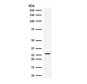 Western blot testing of human kidney lysate with Adiponectin antibody (clone ADPQ-1). Routinely observed at 26~30 kDa.~