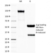 SDS-PAGE Analysis of Purified, BSA-Free Recombinant IgG Antibody (clone IG507R). Confirmation of Integrity and Purity of the Antibody.