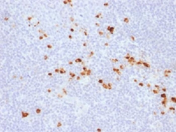 IHC testing of FFPE human tonsil with recombinant IgG antibody (clone IG507R). HIER: steam sections in 10mM citrate buffer, pH 6.0, for 10-20 min.~