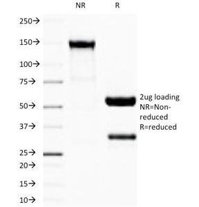 SDS-PAGE Analysis of Purified, BSA-Free Recombinant IgG Antibody (clone IG507R). Confirma