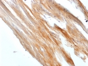 IHC testing of FFPE rat uterus with recombinant Caldesmon antibody (clone CALD1/1424R). Required HIER: boil tissue sections in 1mM EDTA, pH9, for 10-20 min.