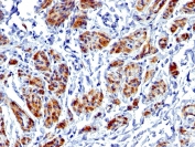 IHC testing of FFPE human uterus with recombinant Caldesmon antibody (clone CALD1/1424R). Required HIER: boil tissue sections in 1mM EDTA, pH9, for 10-20 min.