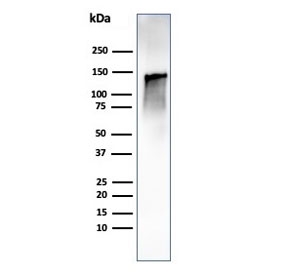 Western blot testing of human ovary tissue lysate using recombinant Caldesmon antibody (clone CALD1/1424R). Predicted molecular weight ~93 kDa, can be observed at 70-80 kDa (non muscle tissue) and 120-150 kDa (smooth muscle).~