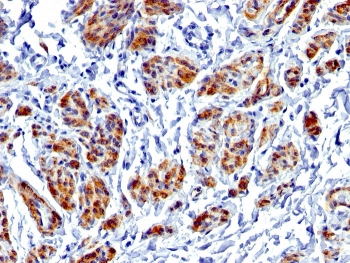IHC testing of FFPE human uterus with recombinant Caldesmon antibody (clone CALD1/1424R). Required HIER: boil tissue sections in 1mM EDTA, pH9, for 10-20 min.~