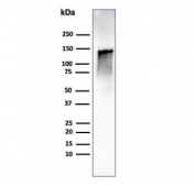 Western blot testing of human ovary tissue lysate using recombinant Caldesmon antibody (clone CALD1/1424R). Predicted molecular weight ~93 kDa, can be observed at 70-80 kDa (non muscle tissue) and 120-150 kDa (smooth muscle).