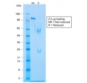 SDS-PAGE analysis of purified, BSA-free recombinant Caldesmon antibody (clone CALD1/1424R) as confirmation of integrity and purity.