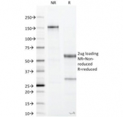 SDS-PAGE Analysis of Purified, BSA-Free Recombinant CA19-9 Antibody (clone CA19.9/1390R). Confirmation of Integrity and Purity of the Antibody.