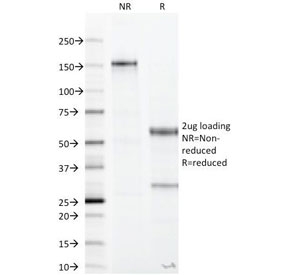 SDS-PAGE Analysis of Purified, BSA-Free Recombinant CA19-9 Antibody (clone CA19