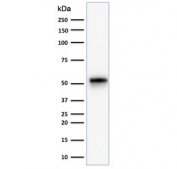 Western blot testing of human HeLa cell lysate with recombinant Cytokeratin 7 antibody (clone KRT7/1499R). Predicted molecular weight ~51 kDa.