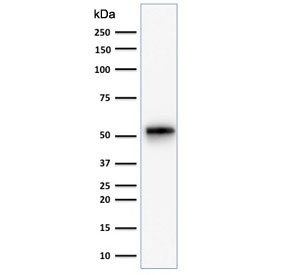 Western blot testing of human HeLa cell lysate with recombinant C
