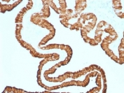 IHC testing of FFPE human oviduct with recombinant Cytokeratin 7 antibody (clone KRT7/1499R). Required HIER: steam sections in pH 9 10mM Tris with 1mM EDTA for 10-20 min.