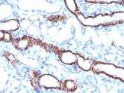 IHC testing of FFPE rat kidney tissue with recombinant Cadherin 16 antibody (clone CDH16/1532R). Required HIER: steam sections in 10mM Tris with 1mM EDTA, pH 9.0, for 10-20 min.