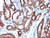 IHC testing of FFPE mouse kidney tissue with recombinant Cadherin 16 antibody (clone CDH16/1532R). Required HIER: steam sections in 10mM Tris with 1mM EDTA, pH 9.0, for 10-20 min.