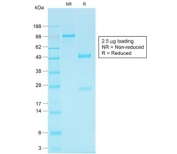 SDS-PAGE analysis of purified, BSA-free recombinant Cadherin 16 antibody (clone CDH16/1532R) as confirmation of integrity and purity.