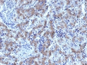 IHC testing of FFPE human fetal liver tissue with recombinant Glypican-3 antibody (clone GPC3/1534R). Required HIER: steam sections in 10mM Tris with 1mM EDTA, pH 9.0, for 10-20 min.