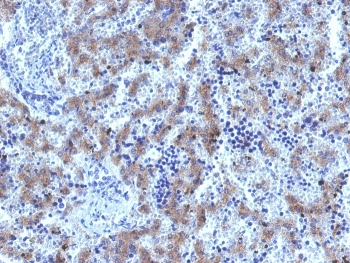 IHC testing of FFPE human fetal liver tissue with recombinant Glypican-3 antibody
