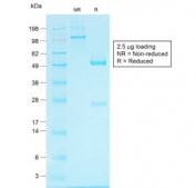SDS-PAGE analysis of purified, BSA-free recombinant Glypican-3 antibody (clone GPC3/1534R) as confirmation of integrity and purity.
