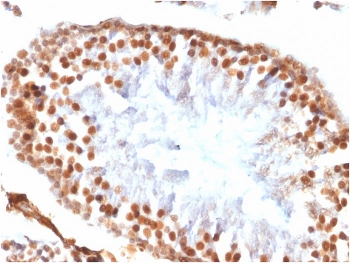 IHC testing of FFPE rat testis tissue with recombinant WT1 antibody (clon