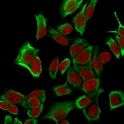 Immunofluorescent staining of MeOH fixed human HeLa cells with recombinant EpCAM antibody (clone EGP40/1555R, green) and Reddot nuclear stain (red).
