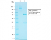 SDS-PAGE analysis of purified, BSA-free recombinant EpCAM antibody (clone EGP40/1555R) as confirmation of integrity and purity.