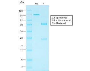 SDS-PAGE analysis of purified, BSA-free recombinant EpCAM antibody (clone EGP40/1556R) as confirmation of integrity and purity.