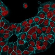 Immunofluorescent staining of human MCF7 cells with recombinant Ep-CAM antibody (clone EGP40/1556R, cyan) and Reddot nuclear stain (red).
