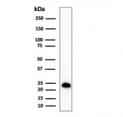 Western blot testing of human COLO-38 cell lysate with recombinant Melan-A antibody (clone MLANA/1761R). Expected molecular weight ~20 kDa with possible doublet.