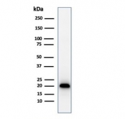 Western blot testing of human COLO-38 cell lysate with recombinatn Melan-A antibody (clone MLANA/1761R). Expected molecular weight ~20 kDa with possible doublet.