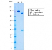 SDS-PAGE analysis of purified, BSA-free recombinant Acidic Cytokeratin antibody (clone KRTL/1577R) as confirmation of integrity and purity.
