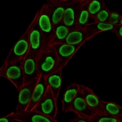 Immunofluorescent staining of permeabilized human HeLa cells with recombinant Histone H1 antibody (green, clone HH1/1784R) and Phalloidin.