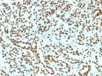 IHC testing of FFPE human pancreas and recombinant Histone H1 antibody (clone HH1/1784R). Required HIER: boil tissue sections in pH 9 10mM Tris with 1mM EDTA for 10-20 min.~