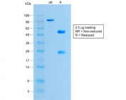 SDS-PAGE analysis of purified, BSA-free recombinant Histone H1 antibody (clone HH1/1784R) as confirmation of integrity and purity.