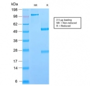 SDS-PAGE analysis of purified, BSA-free recombinant Glycoprotein 2 antibody (clone GP2/2569R) as confirmation of integrity and purity.