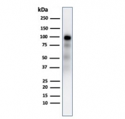 Western blot testing of human pancreas lysate with recombinant Glycoprotein 2 antibody (clone GP2/2569R).