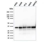 Western blot testing of human cell lysates with APE1 antibody (clone CPTC-APEX1-2). Predicted molecular weight ~38 kDa.