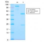 SDS-PAGE analysis of purified, BSA-free recombinant Tenascin C antibody (clone TNC/2981R) as confirmation of integrity and purity.
