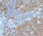 IHC testing of FFPE human tonsil stained with RPSA antibody (clone LMNR-1). Required HIER: boiling tissue sections in pH 9 10mM Tris with 1mM EDTA for 10-20 min followed by cooling at RT for 20 min.