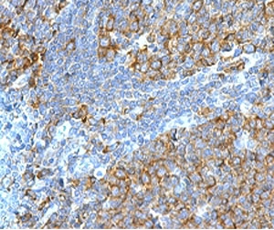 IHC testing of FFPE human tonsil stained with RPSA antibody (clone LMNR-1). Required HIER: boiling tissue sections in pH 9 10mM Tris with 1mM EDTA for 10-20 min followed by cooling at RT for 20 min.