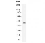 Western blot testing of human HeLa cell lysate with RPSA antibody (clone LMNR-1). Routinely observed molecular weight: 37-40 kDa and 67 kDa.