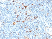 IHC staining of FFPE human tonsil with CD123 antibody. HIER: boil tissue sections in 10mM Tris with 1mM EDTA, pH 9 for 10-20 min and allow to cool.