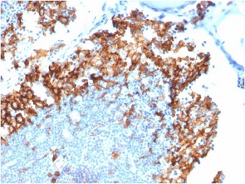 IHC staining of FFPE human lymph node with CD123 antibody. HIER: boil tissue sections in 10mM Tris with 1mM EDTA, pH 9 for 10-20 min and allow to cool.~
