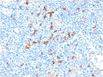 IHC staining of FFPE human tonsil with CD123 antibody. HIER: boil tissue sections in