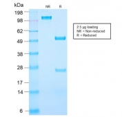 SDS-PAGE analysis of purified, BSA-free recombinant PSA antibody (clone KLK3/2871R) as confirmation of integrity and purity.