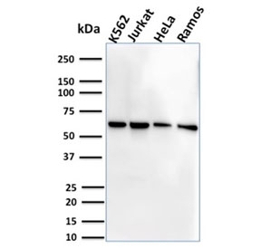 Western blot testing of human cell lysate samples with CD127 antibody (clone IL7R/2751).~