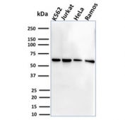 Western blot testing of human cell lysate samples with CD127 antibody (clone IL7R/2751).
